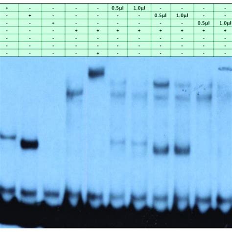 Electrophoretic Mobility Shift Assay For The Most Upstream Region Of