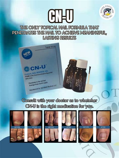 Toenail Restoration Santa Monica | Cosmetic Nail Repair