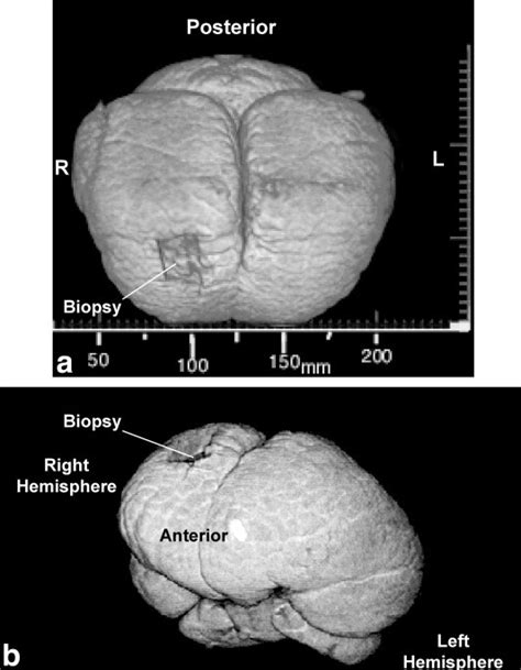 Anatomy And Three‐dimensional Reconstructions Of The Brain Of A