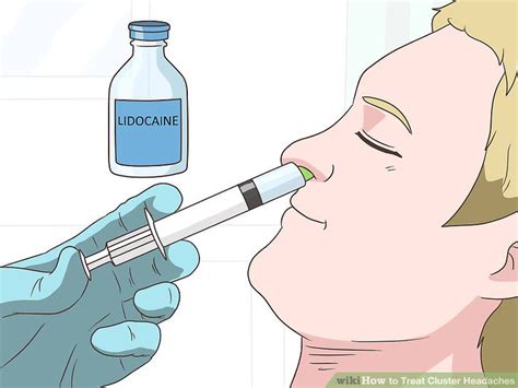 how to treat cluster headaches at home