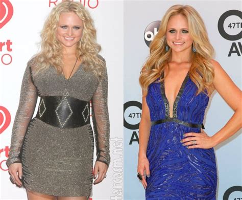 Miranda Lambert before and after plastic surgery (1) – Celebrity ...