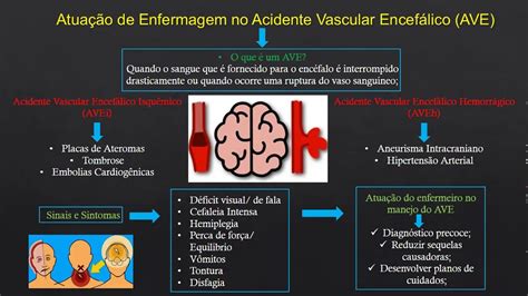 Diagnóstico De Enfermagem Para Avc RETOEDU