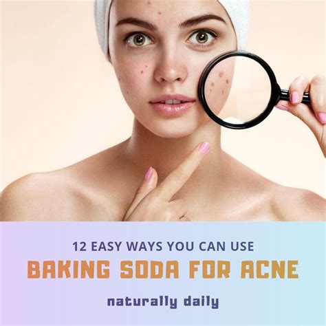 12 Easy Ways You Can Use Baking Soda For Acne Baking Soda For Acne