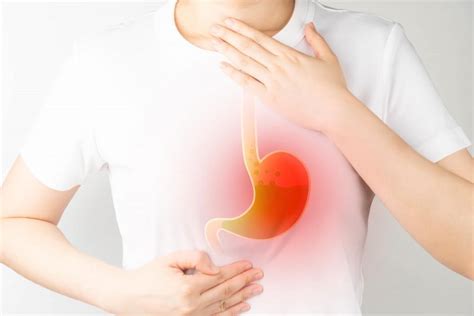 Heres Why You Shouldnt Ignore Heartburn John M Rivas Md Gastroenterology And Endoscopy