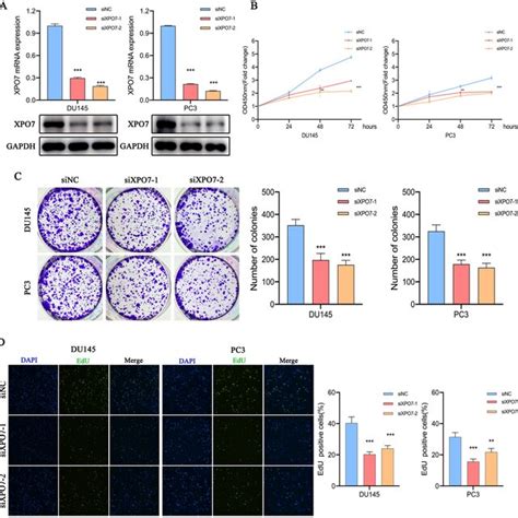 Xpo Knockdown Delays Prostate Cancer Cells Proliferation A The