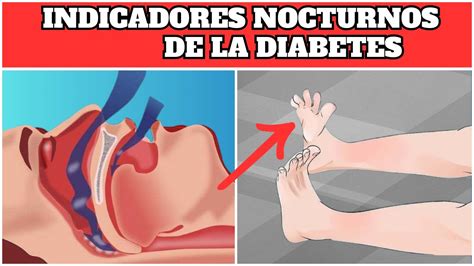 8 Indicadores Nocturnos De Diabetes Que NO DEBES SUBESTIMAR YouTube