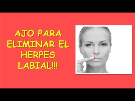 Ajo Para Eliminar El Herpes Labial Remedio Casero Herpes Labial Ajo