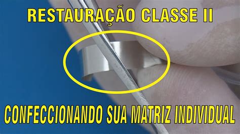 Restauração Classe II Você Confeccionando a Matriz Individual PARTE 2