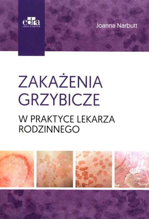 Zakażenia grzybicze w praktyce lekarza rodzinnego Joanna Narbutt