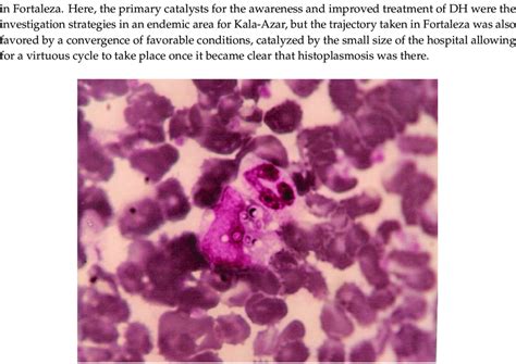 Histoplasma Capsulatum Yeasts On A Stained Buffy Coat Giemsa 100