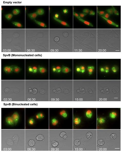 Confocal Time Lapse Imaging Of Infected Cell With Salmonella MPO325