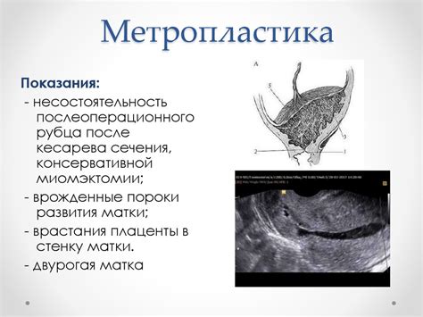 Как быстро прийти в себя после кесарева сечения: Быстрое восстановление ...