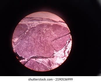 Histology Eye Ear Skin Using Microscope Stock Photo 2190536999 ...