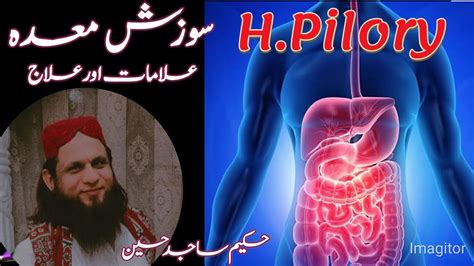 Maiday Ki Sozish Ka Ilaj H Pilory Herbal Treatment Gastritis