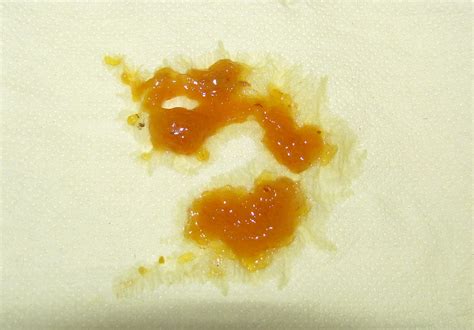 Great Orange Stool With Mucus in the world The ultimate guide | stoolz