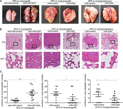 Overexpression Of Mir 200c Suppress Nsclc Cells Metastases In Vivo A Download Scientific