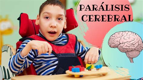 10 CARACTERÍSTICAS BÁSICAS DE LA PARÁLISIS CEREBRAL YouTube