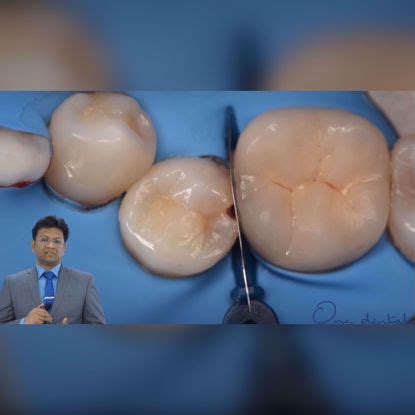 Short Videos The OD Clinical Skills Program One Dental Is The Biggest