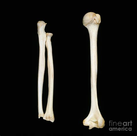 Right Humerus, Radius And Ulna Photograph by VideoSurgery - Pixels