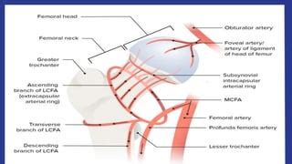 Safe Surgical Dislocation of Hip Joint.pptx