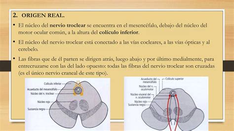 IV PAR CRANEAL NERVIO TROCLEAR Ppt