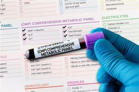 Understanding High Chloride Levels: Causes and Treatment