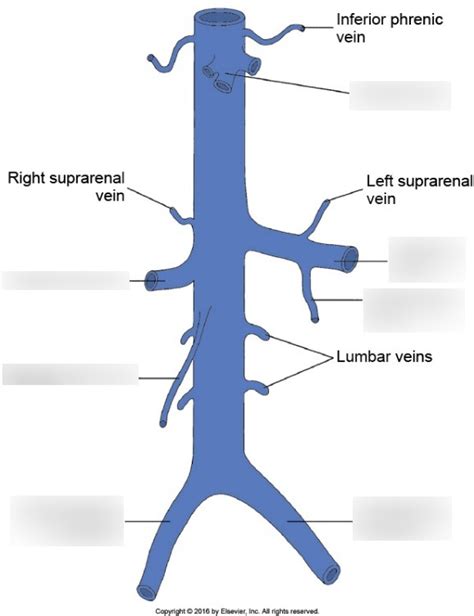 IVC diagram Diagram | Quizlet