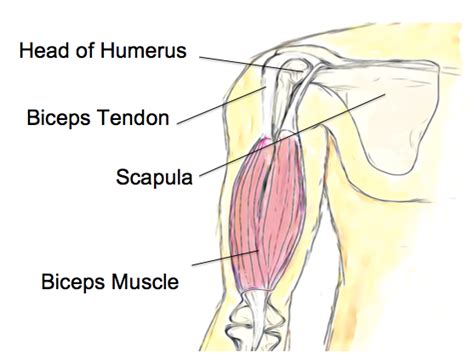 Biceps Tendinopathy Beachbox Physiotherapy