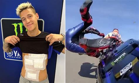 Fabio Quartararo Bears Brutal Injuries From Dramatic Crash At The