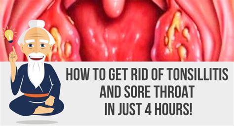 How To Cure Tonsillitis And Sore Throat In Only 4 Hours! – HEALTHY FOOD ...