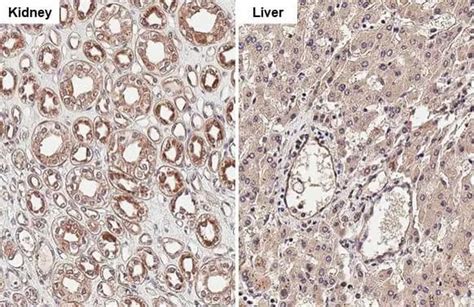 Cathepsin S Antibody HL2302 Azide And BSA Free NBP3 25398 By