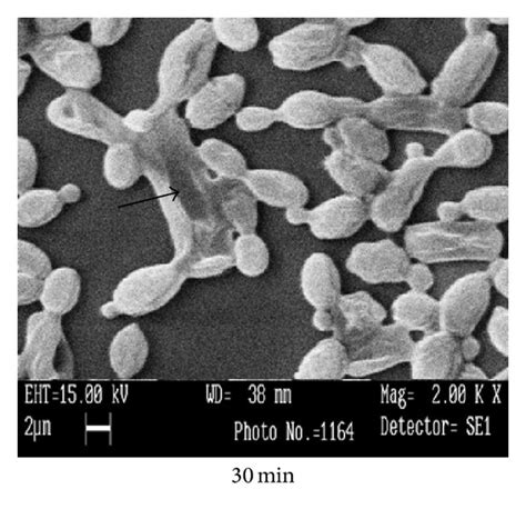 Sem Study Showing The Cell Wall Disruption Of Candida Krusei Treated