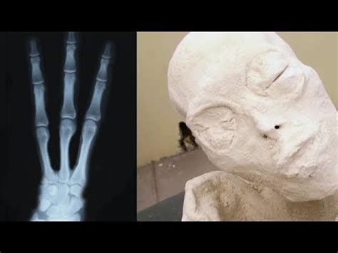 Three Fingered Mummy Discovered In Nazca Peru Nazca Mummies