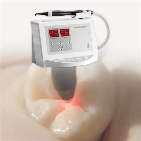 DIAGNOdent Laser Cavity Detection Technology Something To Smile About