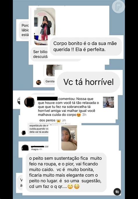 Filha De Fl Via Alessandra Giulia Costa Mostra Marcas No Corpo Ap S