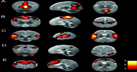 Theories of Consciousness Must Be Biological | by Paul Austin Murphy ...