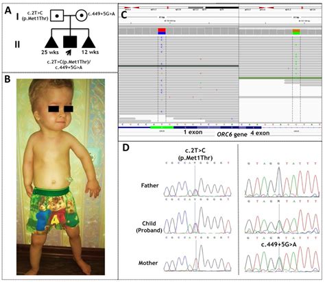 Ijms Free Full Text Meiergorlin Syndrome Clinical Misdiagnosis