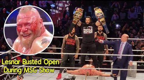 Brock Lesnar Busted Open During Wwe Madison Square Garden Show Youtube