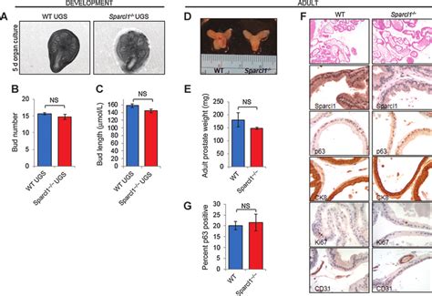 Sparcl1 Is Not Necessary For Prostate Development Ac Bud Number And Download Scientific