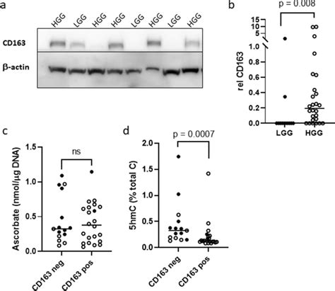 Infiltrating Macrophages In Glioma Tumours A Relative Cd163 Was Download Scientific Diagram