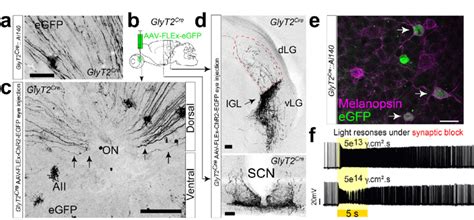 A Subpopulation Of IpRGCs In Dorsal Retina A RGC Axons Identified In