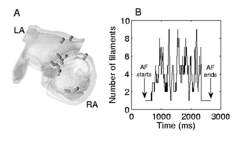 Abstract Vortex Filament Characteristics During Atrial