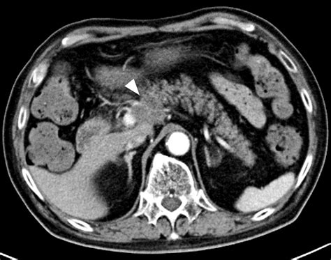 Figure1 Contrast Enhanced Computed Tomography Image Of The Abdomen Download Scientific Diagram