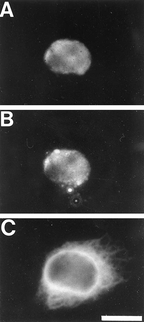 Effect Of Demecolcine Treatment On Intracellular Distribution Of Mrp