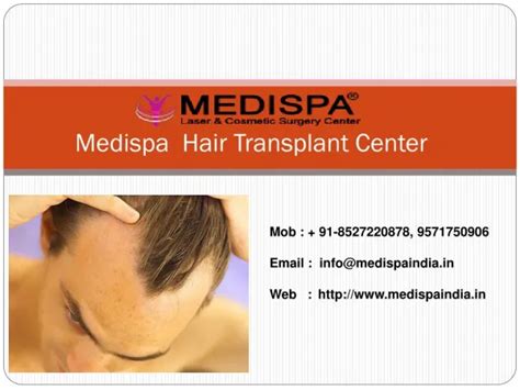 Ppt 3 Reasons To Get Proper Hair Transplant Powerpoint Presentation Free Download Id 11623913