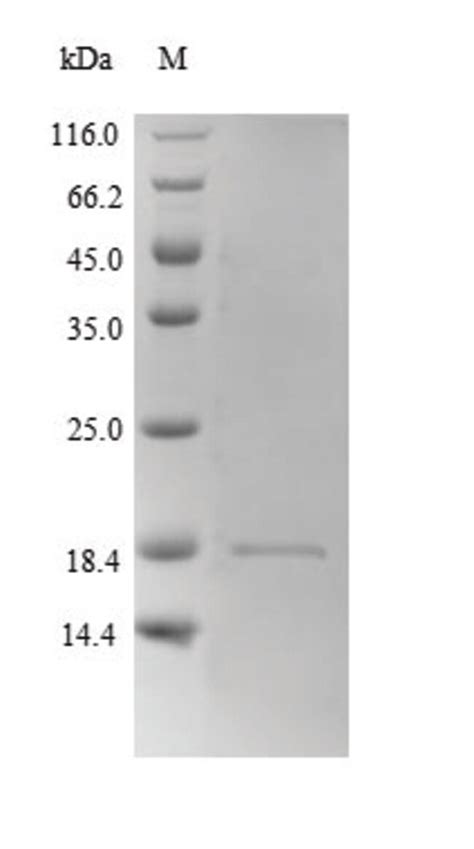 enQuireBio™ Recombinant Mouse Hemoglobin subunit beta-2 Protein 10μg enQuireBio™ Recombinant ...