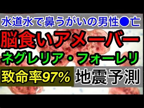 危険水道水で鼻うがい脳食いアメーバー致命率97のネグレリアフォーレリーに感染した男性 亡 保健当局が水道水を煮沸して使用する