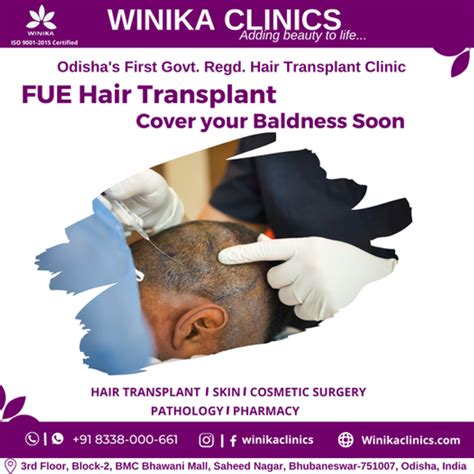 Know The Success Rate Of Fue Hair Transplant Without Shaving The Head