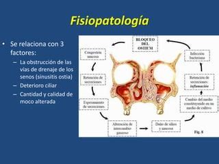 Rinosinusitis crónica y sus complicaciones PPT Descarga Gratuita