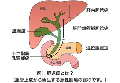 胆道の主な病気と診療実績 三重大学 肝胆膵移植外科第一外科